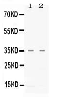 Polyclonal Rabbit anti-Human CXCL16 Antibody (WB)