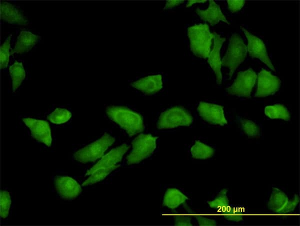 IHC-plus™ TRAF3IP2 / ACT1 Antibody (clone 4A3)