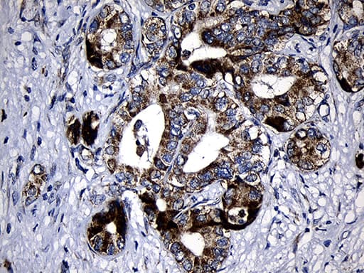 PCCA Antibody (clone OTI1E9, Carrier-free)