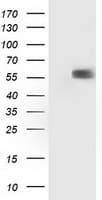 Monoclonal Mouse anti-Human TP53 / p53 Antibody (clone OTI1F4, IHC, WB)