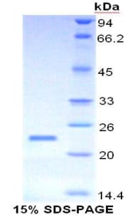 Human MUC4 Protein (Recombinant His)