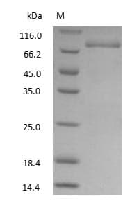 TF / Transferrin Protein (Native)