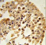 Dipeptidylpeptidase 8 / DPP8 Antibody (aa23-52)