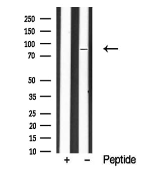 EIF2B5 Antibody