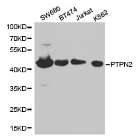 PTPN2 / TC-PTP Antibody