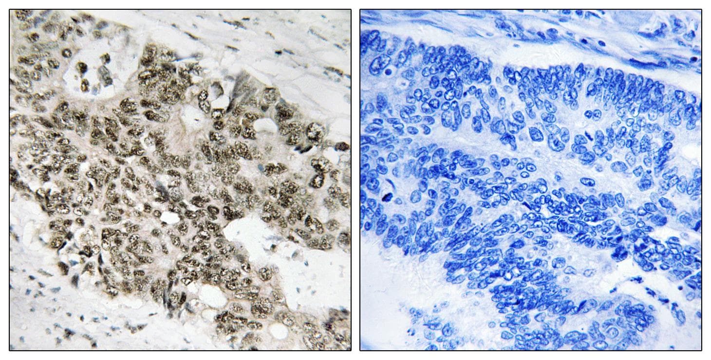 Polyclonal Rabbit anti-Human ATR Antibody (Ab-428, IHC)