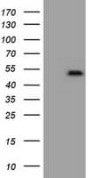 ZSCAN4 Antibody (clone OTI3B1)