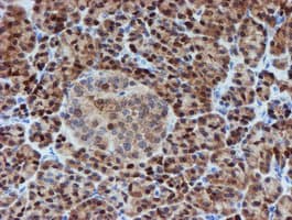 SAT2 Antibody (clone OTI2B3)