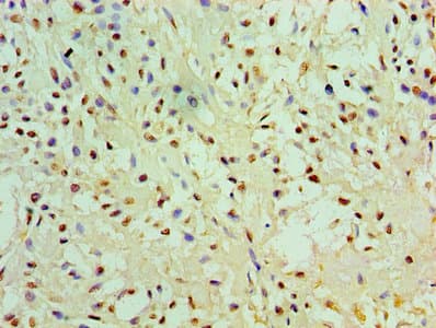 EGLN2 / PHD1 Antibody