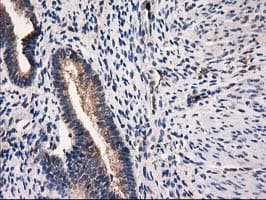 CAT / Catalase Antibody (clone OTI1B8)