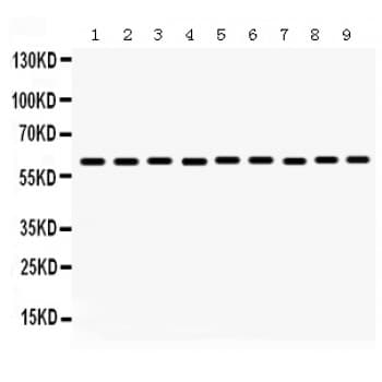 MAOB / Monoamine Oxidase B Antibody (aa448-484)