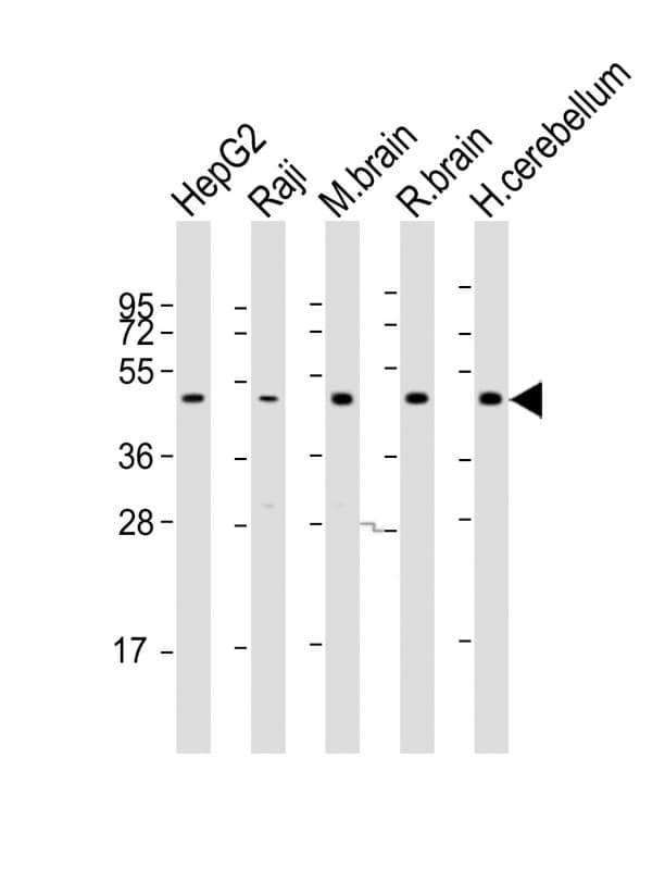 Polyclonal Rabbit anti-Human GNAS Antibody (aa51-83, WB)