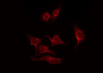 PRKCB / PKC-Beta Antibody
