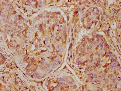 ANXA5 / Annexin V Antibody (aa2-320)
