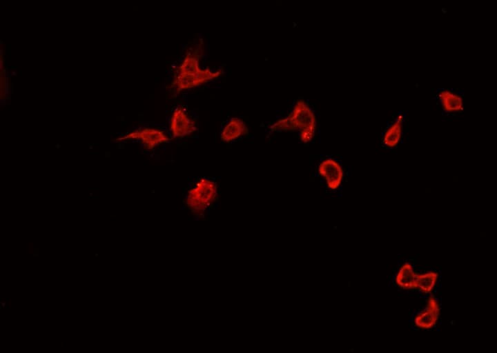 Polyclonal Rabbit anti-Human SYK Antibody (phospho-Tyr323, IHC, IF, WB)