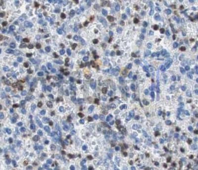 SYK Antibody