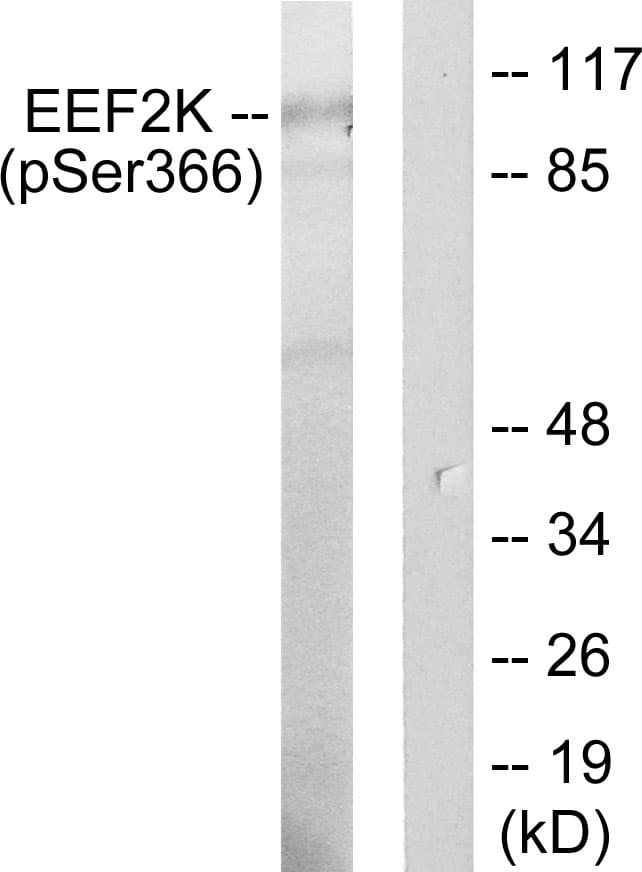 EEF2K Antibody (phospho-Ser366)