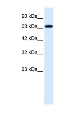 Polyclonal Rabbit anti-Human SPRING / TRIM9 Antibody (C-Terminus, IHC, WB)