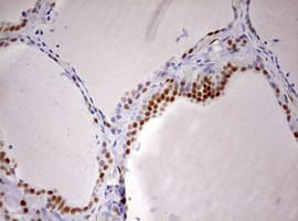 DDX56 Antibody (aa323-547, clone OTI2E5)