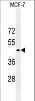 GFAP Antibody