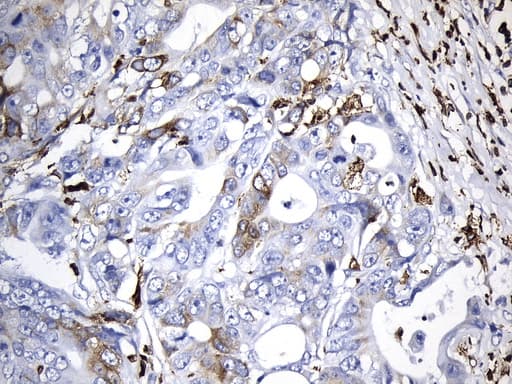 CD74 / CLIP Antibody (clone UMAB232, Carrier-free)