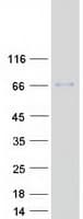 Human RNGTT / HCAP Protein (Recombinant Myc-DDK (Flag))
