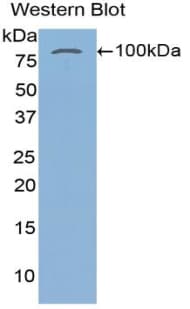 TGM2 / Transglutaminase 2 Antibody (aa1-687, Biotin)