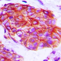 Polyclonal Rabbit anti-Human CLDN6 / Claudin 6 Antibody (aa103-137, IHC, IF, WB)