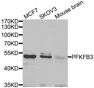 IHC-plus™ Polyclonal Rabbit anti-Human PFK2 / PFKFB3 Antibody (IHC, IF, WB)