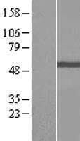 IFT81 Protein (Over-Expression Lysate Myc-DDK (Flag))