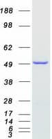Human NDUFAF7 Protein (Recombinant Myc-DDK (Flag))