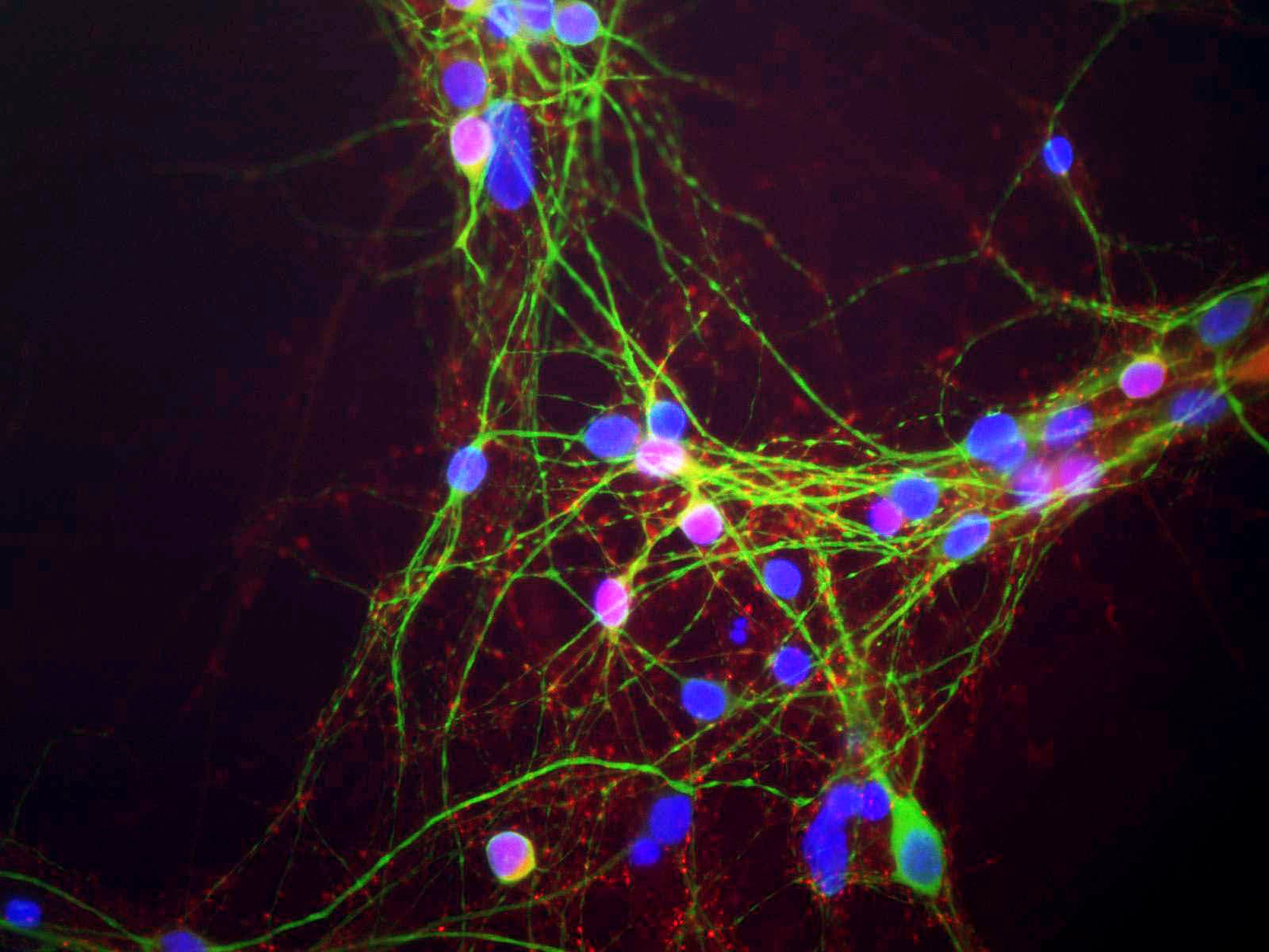SNCA / Alpha-Synuclein Antibody (clone 2A7)