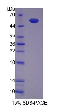 Human CCT2 / CCT Beta Protein (Recombinant His-S)