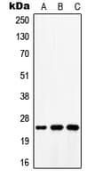 Polyclonal Rabbit anti-Human ATP5S Antibody (Internal, WB)