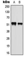 ATF2 Antibody (phospho-Ser112)