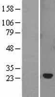 Human SOCS2 Protein (Over-Expression Lysate Myc-DDK (Flag))