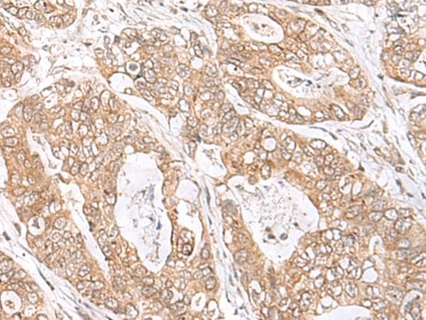 SPC18 / SEC11A Antibody