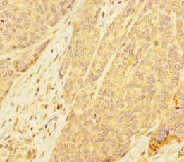 PDE6A / PDE6 Alpha Antibody