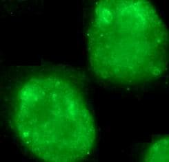 MKI67 / Ki67 Antibody