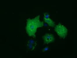 Monoclonal Mouse anti-Human HDAC10 Antibody (clone OTI1B1, IF, WB)