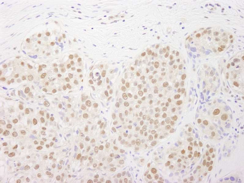 RTF1 Antibody (C-Terminus)