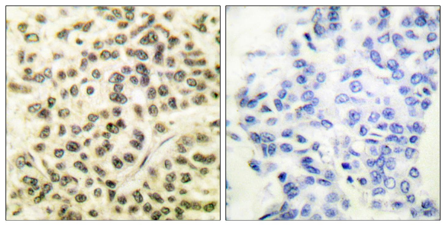 MAPKAPK2 / MAPKAP Kinase 2 Antibody (phospho-Thr334)