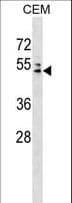 Polyclonal Rabbit anti-Human AP4M1 Antibody (aa223-251, WB)