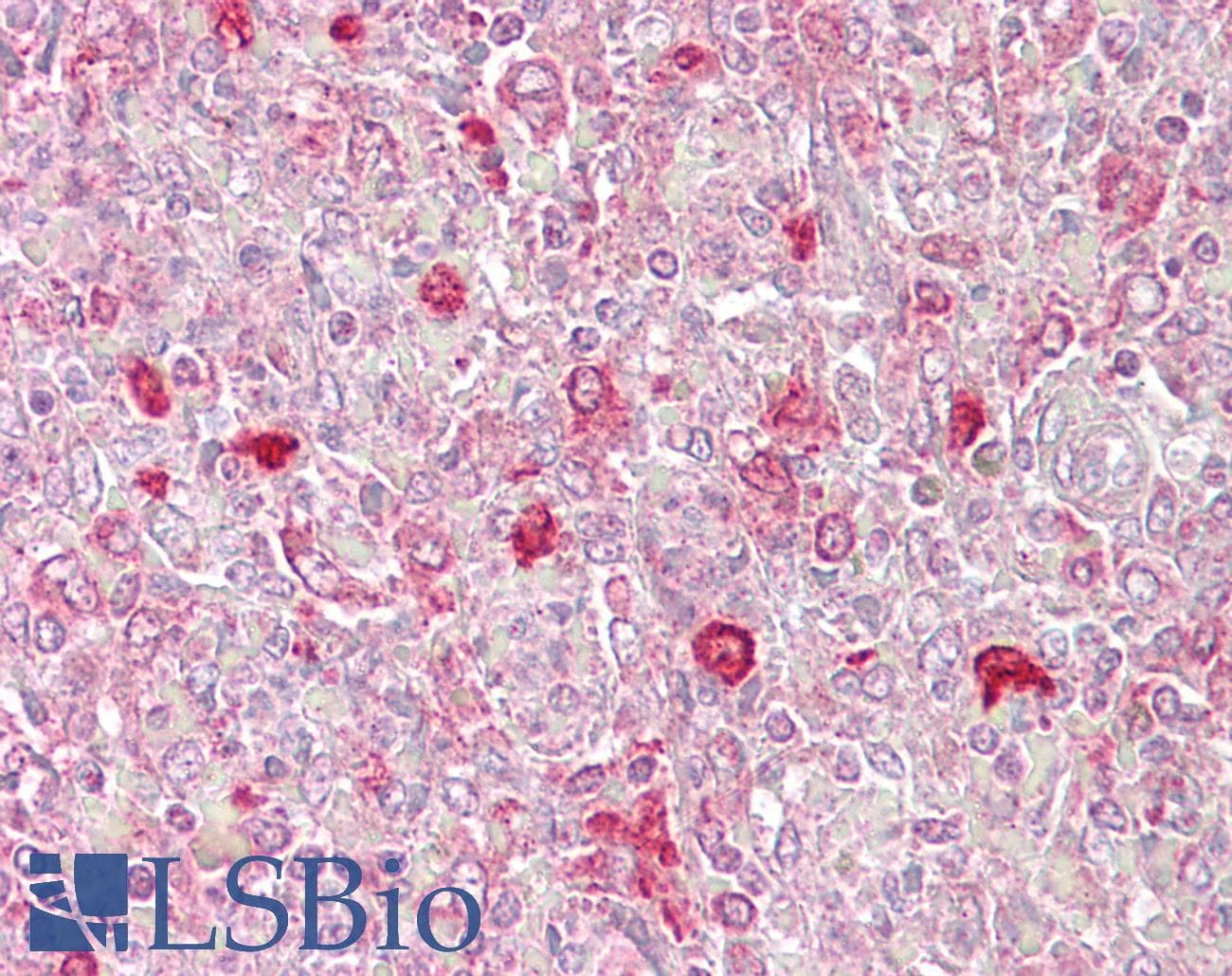 Polyclonal Rabbit anti-Human ATF1 Antibody (C-Terminus, IHC, WB)