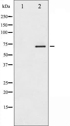 ER Alpha / Estrogen Receptor Antibody (phospho-Ser118)