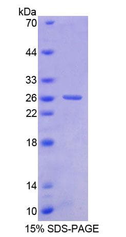 Human BNC1 / Basonuclin Protein (Recombinant His-T7)