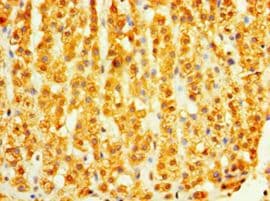 DHRS7 Antibody (aa29-339)