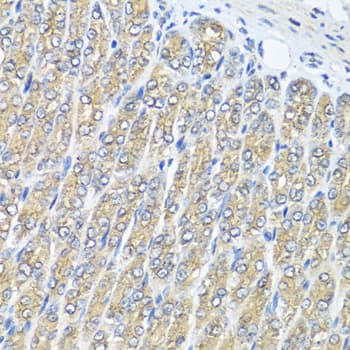 RAC2 Antibody
