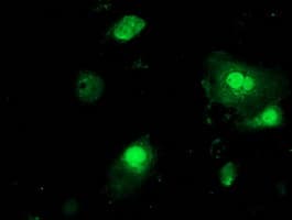 PNMT Antibody (clone OTI2A2, Carrier-free)