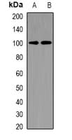 CHM / REP1 Antibody